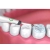 Skaler dentystyczny ultradźwiękowy do czyszczenia zębów usuwanie kamienia