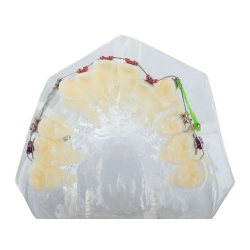 Model stomatologiczny szczęka zęby zębów aparat ortodontyczny