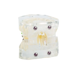 Model stomatologiczny szczęka zęby zębów aparat ortodontyczny