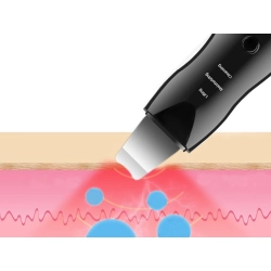 Peeling kawitacyjny do twarzy ultradźwiękowy aku