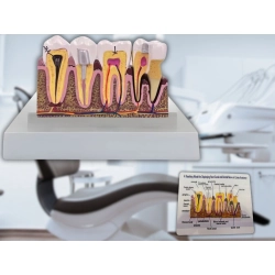 Model anatomiczny zęba stomatologiczny edukacyjny przekrój wyjmowany ząb