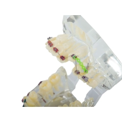 Model stomatologiczny szczęka zęby zębów aparat ortodontyczny