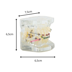 Model stomatologiczny szczęka zęby zębów aparat ortodontyczny