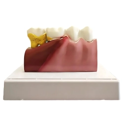Model anatomiczny zęba stomatologiczny edukacyjny przekrój wyjmowany ząb