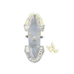 Model stomatologiczny szczęka zęby zębow implanty