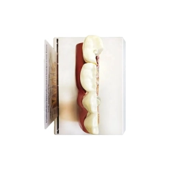 Model anatomiczny zęba stomatologiczny edukacyjny przekrój wyjmowany ząb