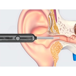 Endoskop otoskop z kamerką wifi do czyszczenia uszu narzędzia zestaw smart