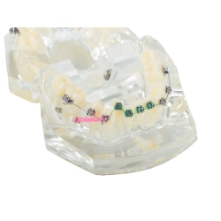 Model stomatologiczny szczęka zęby zębów aparat ortodontyczny