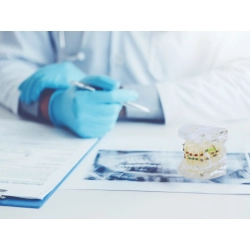 Model stomatologiczny szczęka zęby zębów aparat ortodontyczny