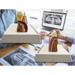 Model anatomiczny zęba stomatologiczny edukacyjny przekrój wyjmowany ząb